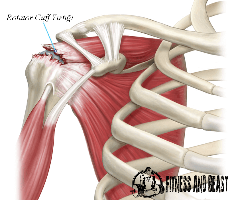 rotator cuff sendromu tedavisi fitnessandbeast